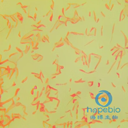 霍乱菌株(霍乱病毒)