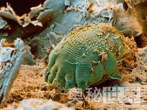 人体寄生虫有哪些(人体寄生虫图片)