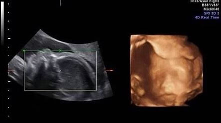 胎动在左边是什么胎位(孕晚期胎动都在左边怎么回事)