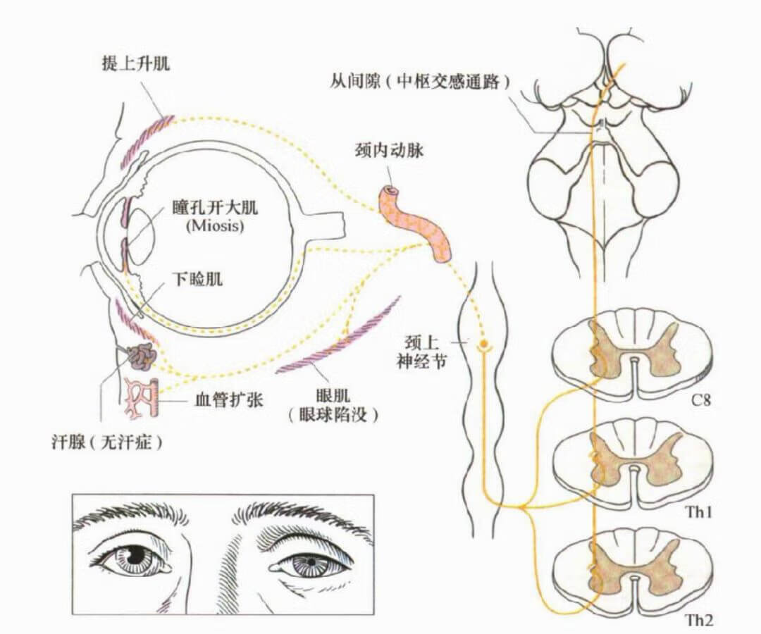 眼睑是哪