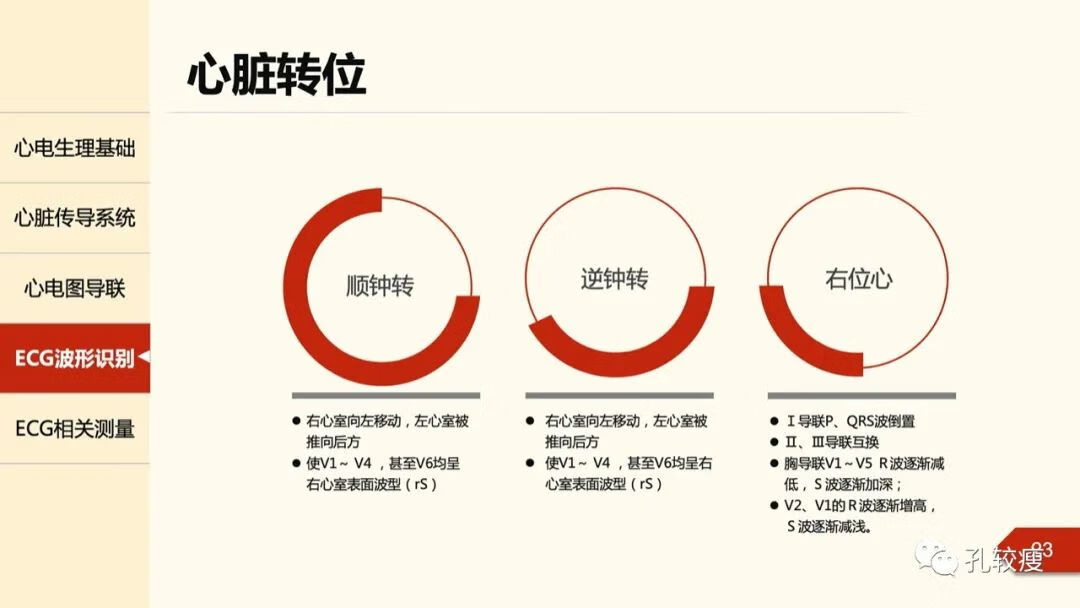 心电图导联位置示意图(心电图机导联位置图)