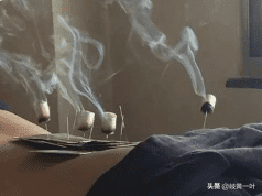 艾灸法包括哪些(自己艾灸方法图解大全)