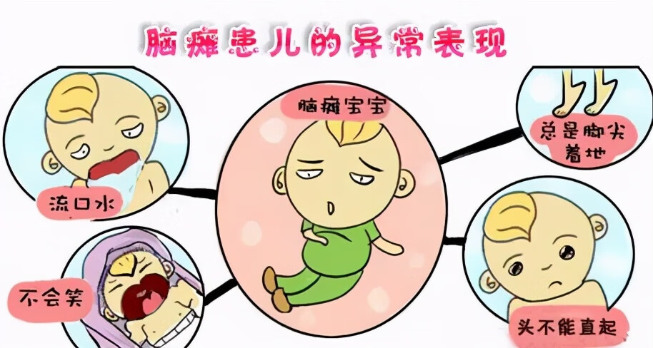 发烧脑瘫儿的症状(脑瘫是什么表现症状)