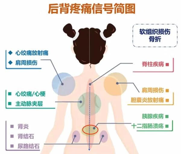 身体背部疼痛的原因(后背里面疼痛是什么原因)