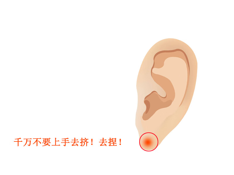 耳垂里有硬疙瘩怎么办(耳垂里面老是反复长硬疙瘩)
