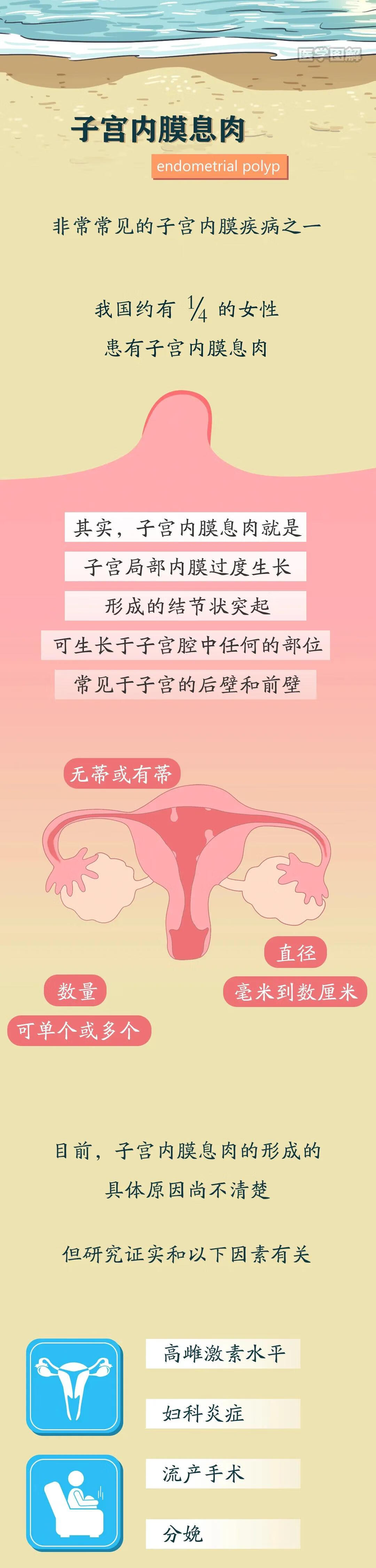 子宫内膜息肉的费用(电切子宫内膜息肉多少钱)