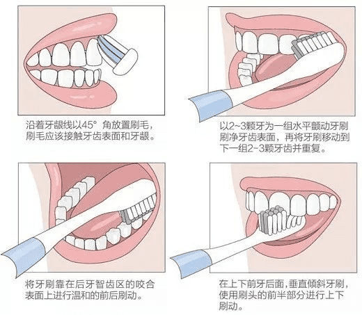 1岁宝宝口臭怎么处理(口臭怎么改善)