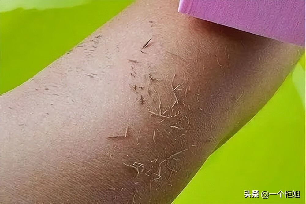 去死皮膏真的有用吗(相宜本草死皮膏有用吗)
