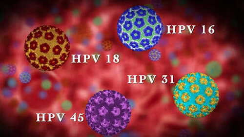 丁pv病毒c(hpv病毒是艾滋病吗)
