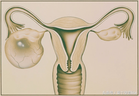 孕18周子宫有多大图片图片