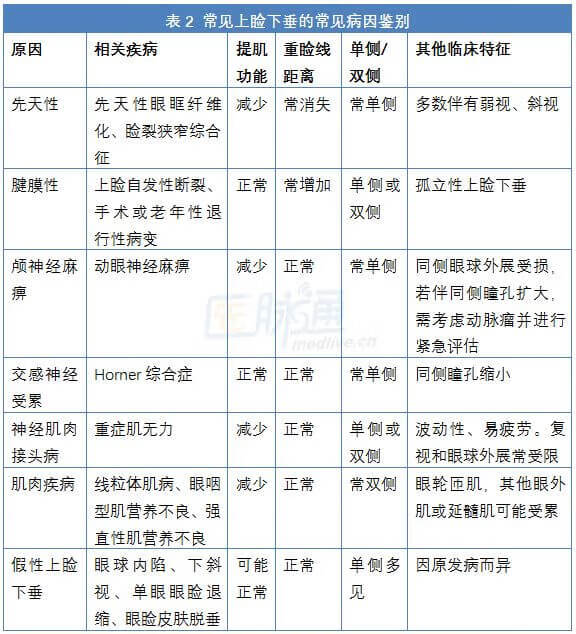 眼睑是哪