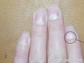 指甲半月痕代表什么(手指甲半月痕是什么意思)
