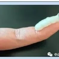 慢性湿疹图片(急性湿疹自己能好吗)
