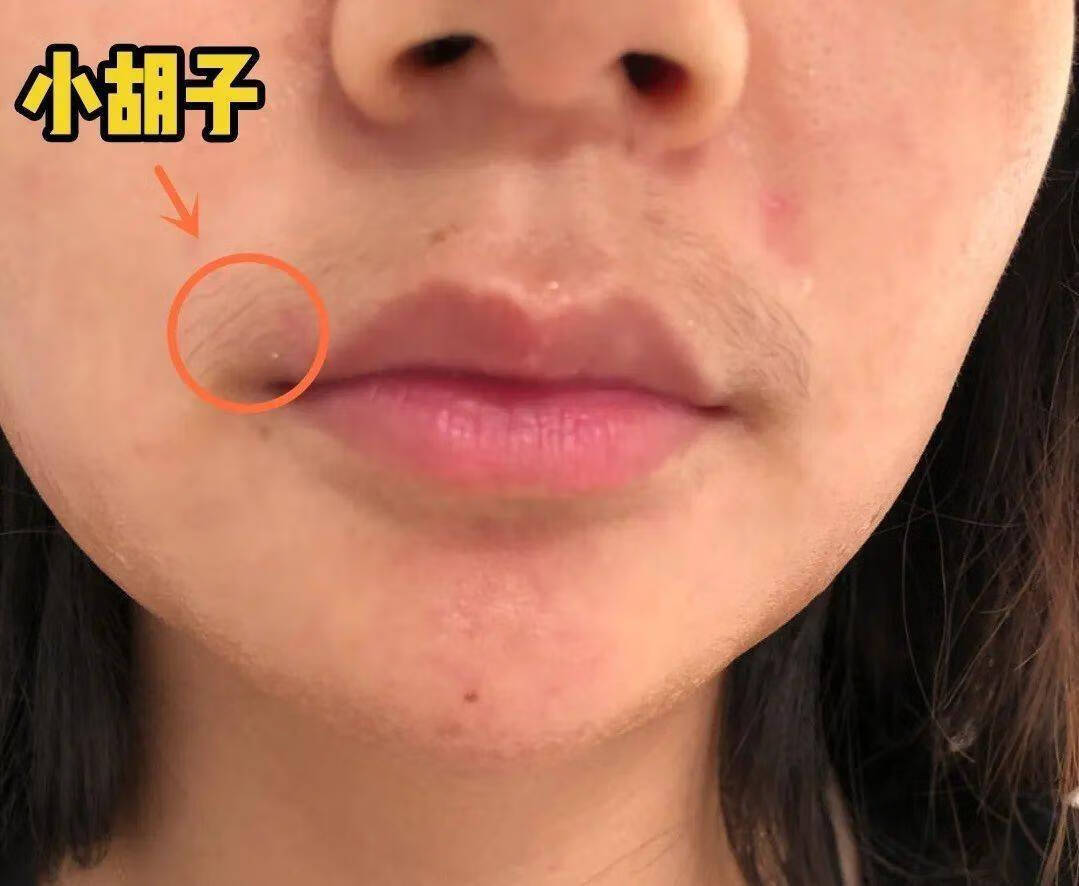 女生长胡子怎么办?(女生有胡子怎么办)
