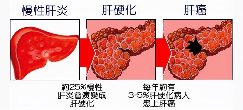 乙肝两对半检查什么项目(乙肝两对半检查怎么做)