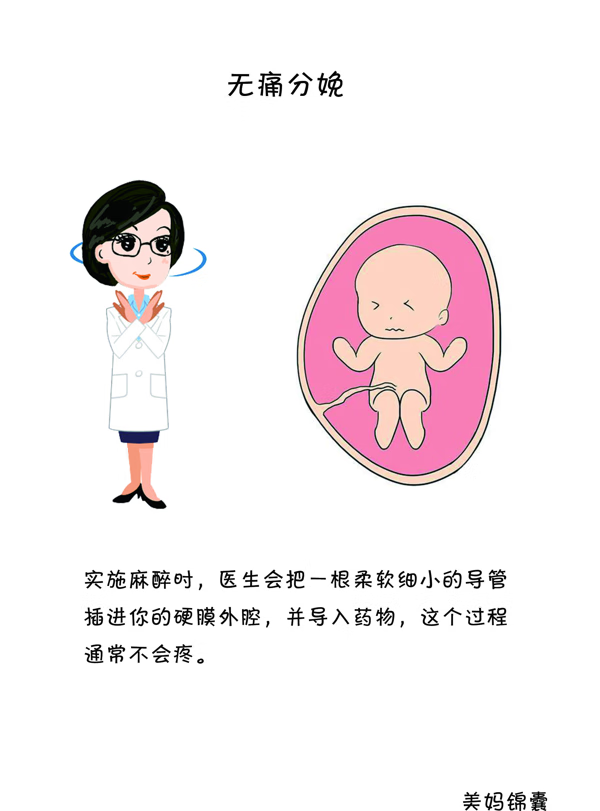 什么是无痛分娩啊(什么是女性的无痛分娩)