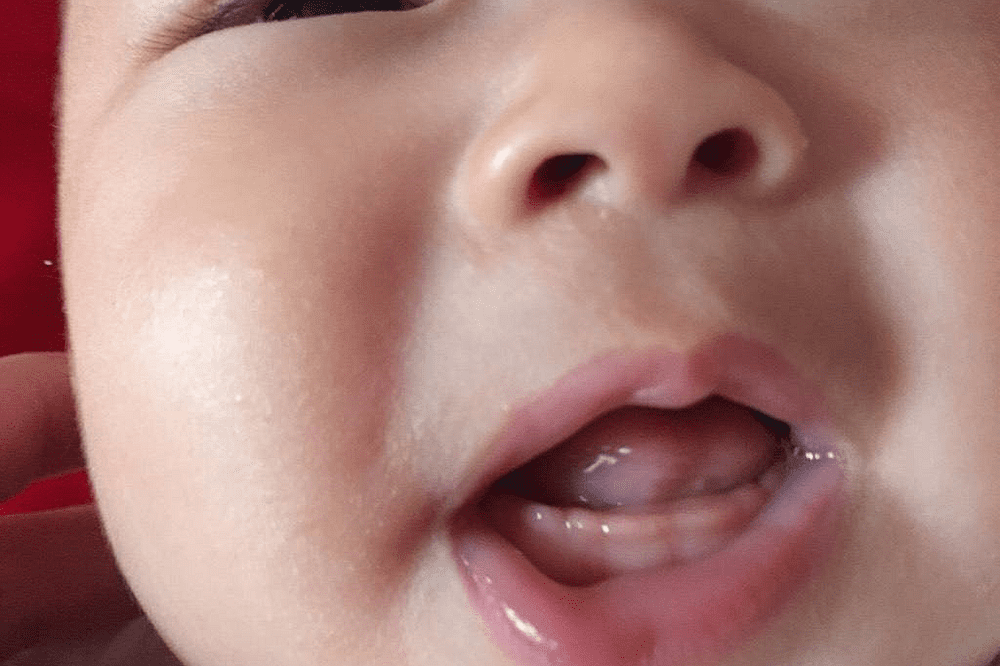 宝宝长牙顺序图解(儿童长牙的顺序示意图)