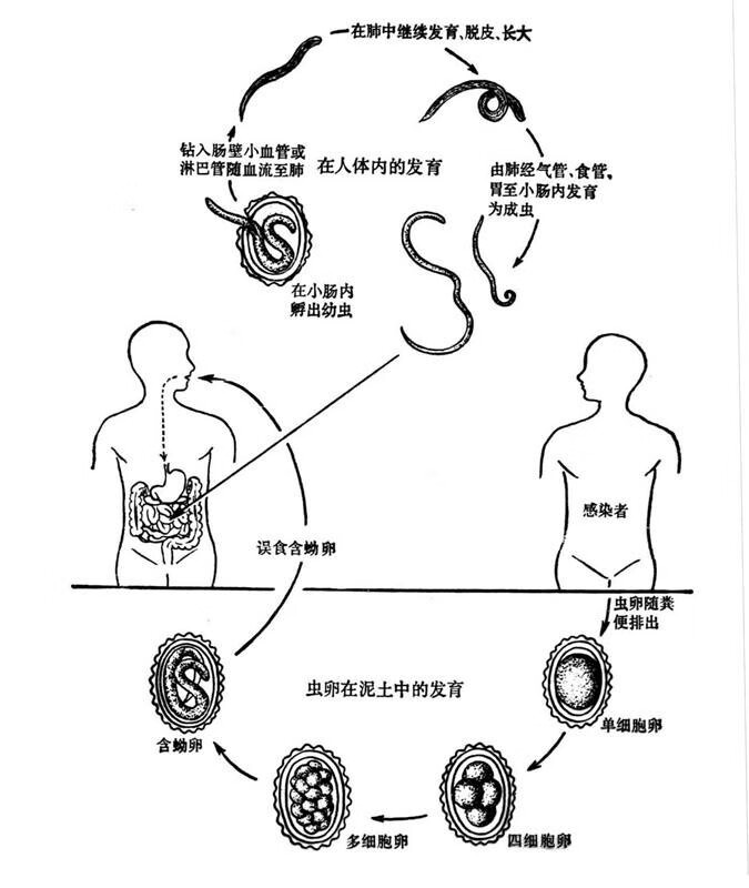 肠道蛔虫症图片