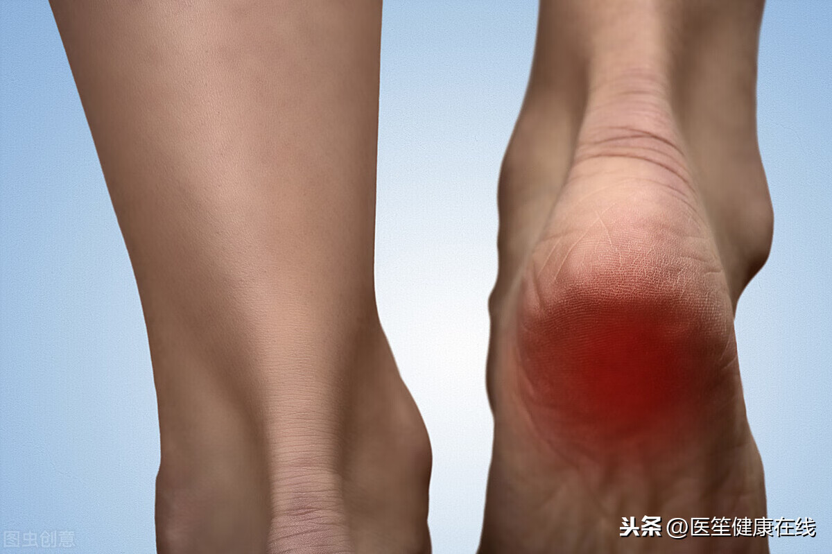 脚底板疼怎么治疗(整个脚底板疼如何缓解)