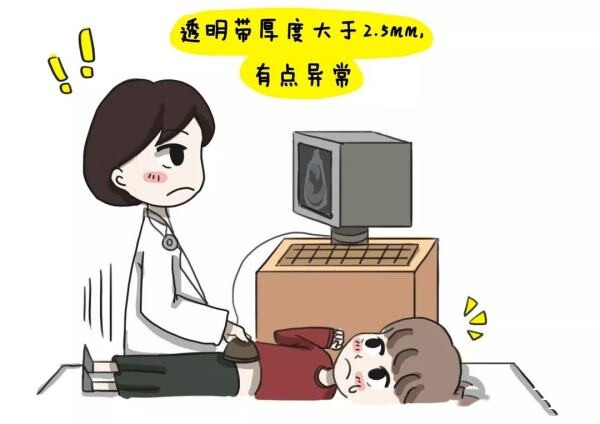 小儿唐氏综合征怎么引起的(小儿唐氏综合征特点)