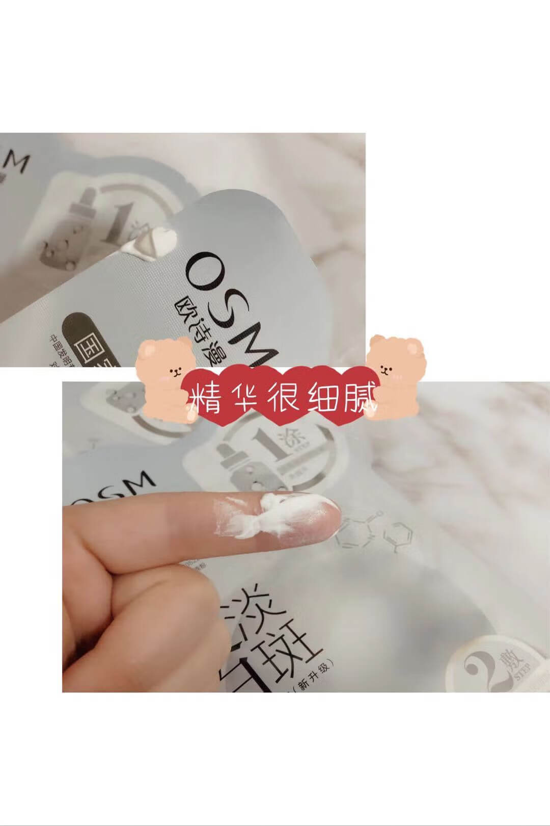 孕期祛斑产品(怀孕斑怎么去除)