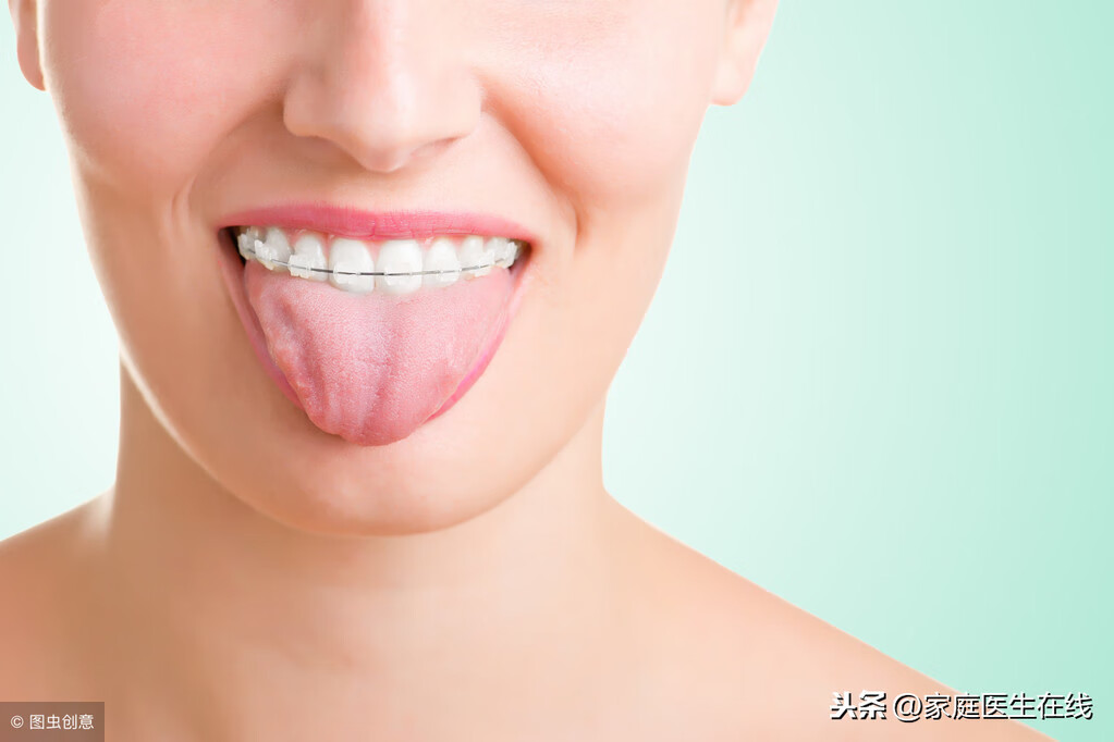 大人舌头上有白色的舌苔是怎么回事(整个舌头都是白色舌苔)