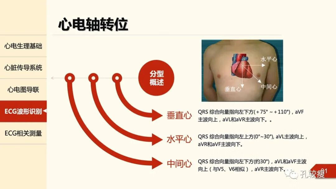 心电图导联位置示意图(心电图机导联位置图)