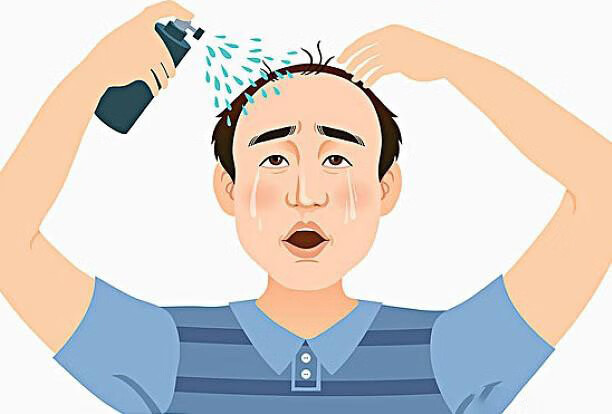 头发掉的非常厉害是怎么回事(头发掉的厉害是咋回事)