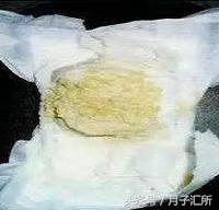 宝宝大便黑色颗粒(宝宝大便有点黑色)