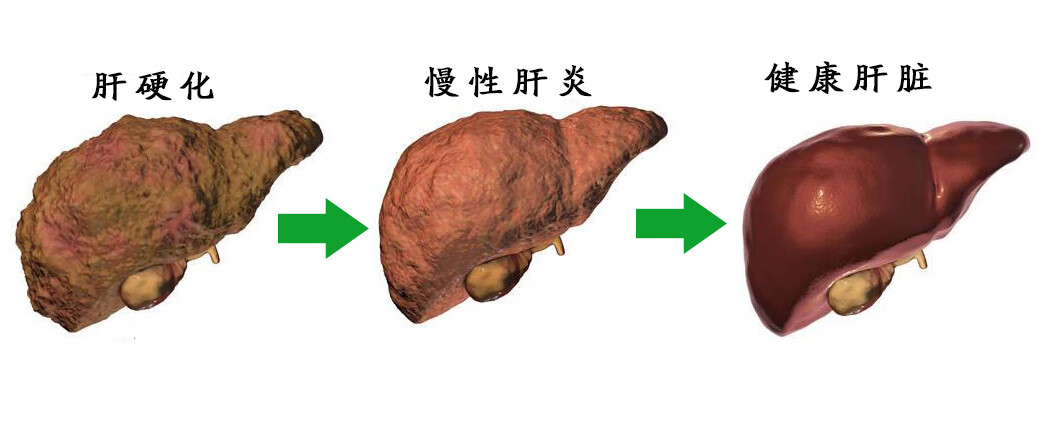 大三陽的症狀表現(大三陽早期有哪些症狀)