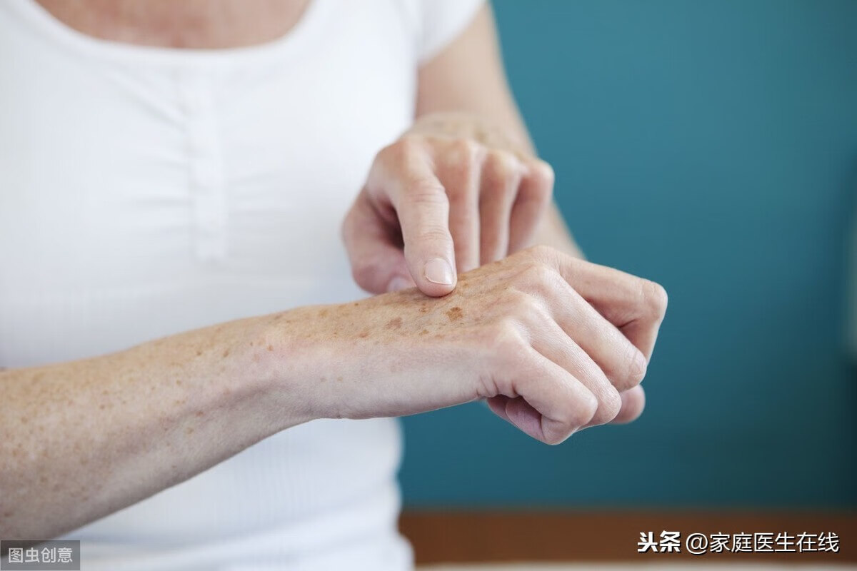 脸上起老年斑怎样去除(脸上长老年斑怎么样才能去除)