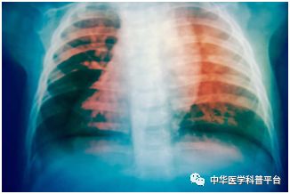 盗汗的原因有哪些(盗汗是什么原因导致的)