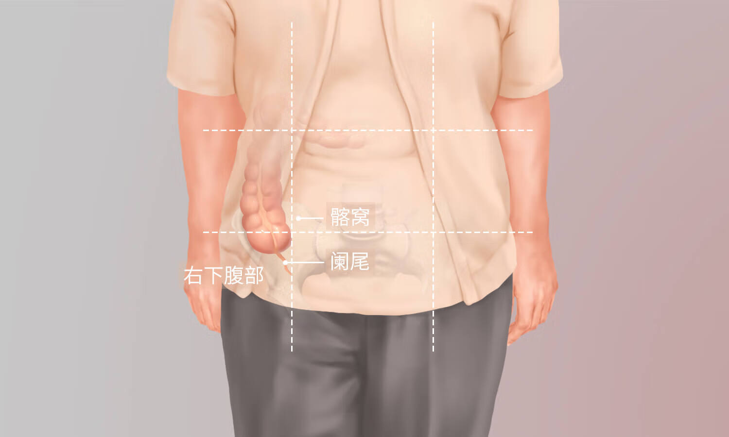 请问阑尾炎在左边还是右边(女性阑尾炎在左边还是右边)