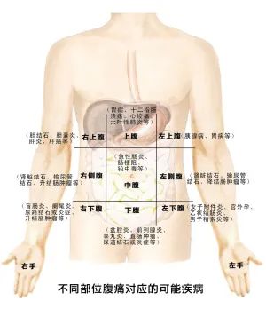 肚子疼是怎么回事?(肚子痛是什么情况)