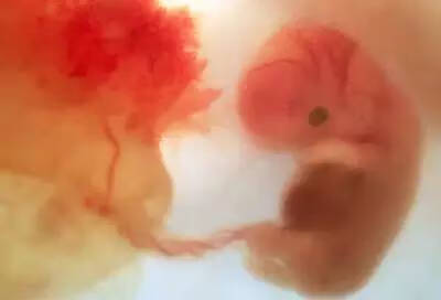 怀孕胎儿发育过程图片(宝宝胚胎发育过程图)