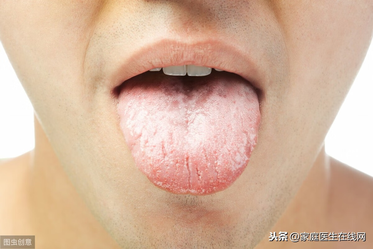 整个舌头发白什么原因(舌头发白什么原因怎么治疗)