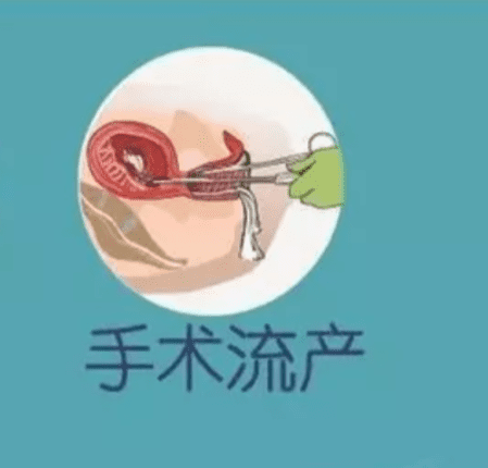 人流注意事项有哪些(人流要注意些什么)