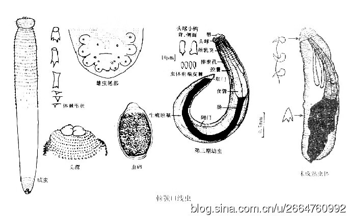 生鱼片寄生虫有哪些(生鱼片寄生虫感染症状)
