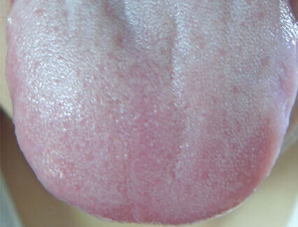 舌苔上白色的东西很厚是什么原因(舌苔老是发白很厚是什么情况)