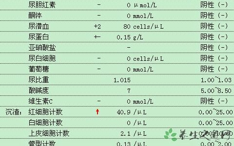 尿常规检查什么项目(尿常规能检查出什么)