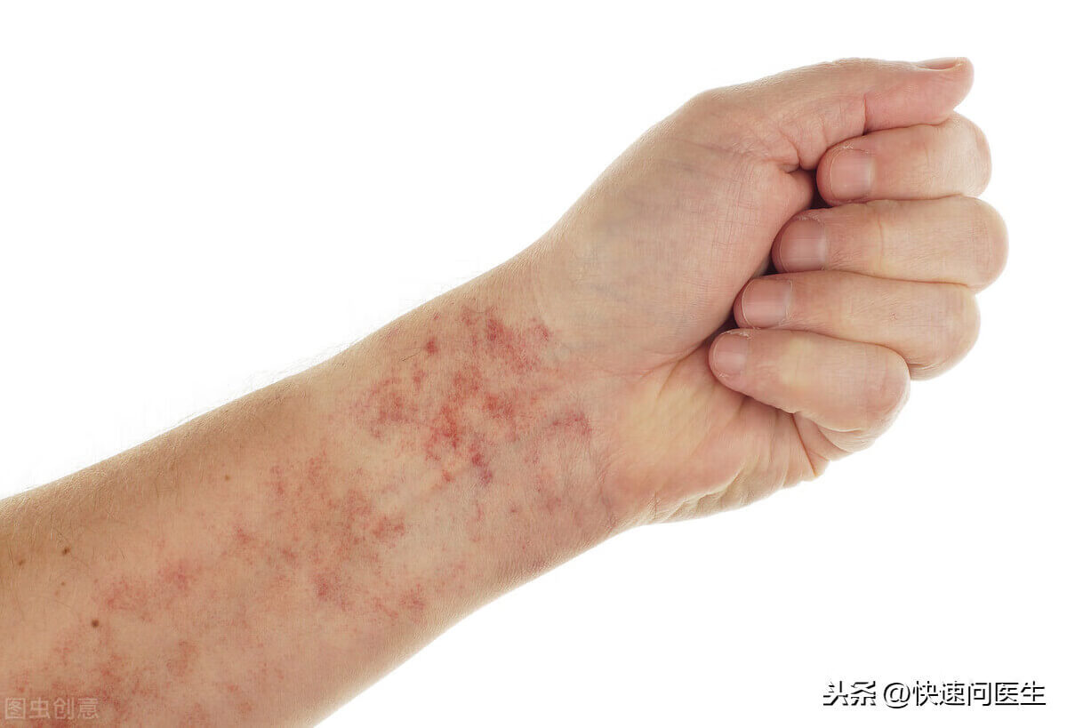 手臂上有小红点点(胳膊上有红色的小点点)