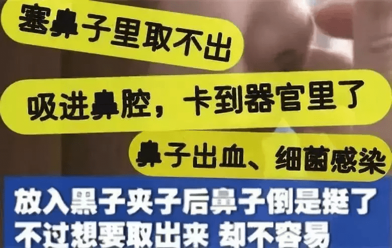隆鼻精油吧(隆鼻精油真的有用吗)