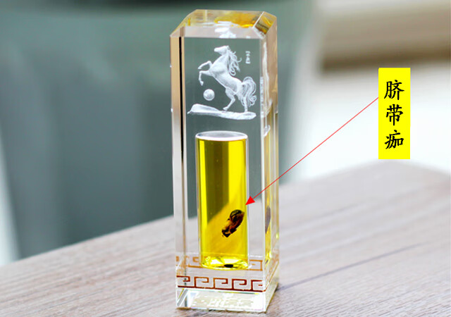脐带脱落后怎么处理(婴儿脐带脱落要不要扔)