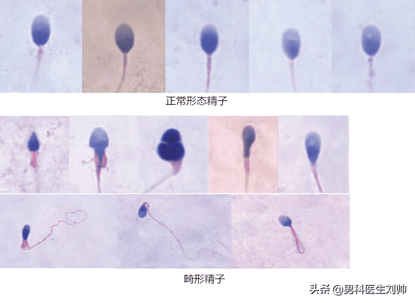 精液检测(医院检查精子多少钱一次)