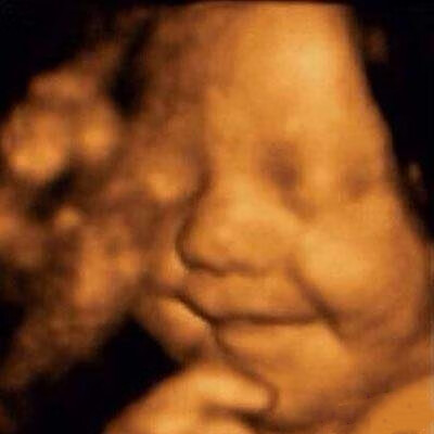 怀孕五个月胎儿彩超(怀孕五个月女孩彩超图片)