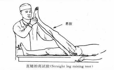 直腿伸踝试验图片