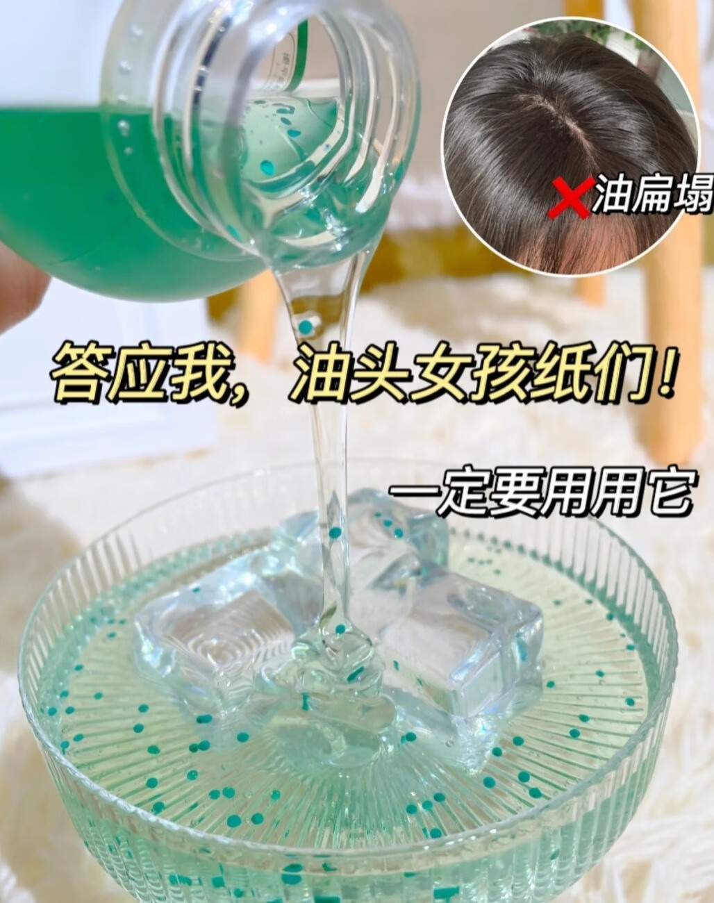 守住你的发量，Spes无硅油持久控油蓬松防脱洗发水-JinMo之家