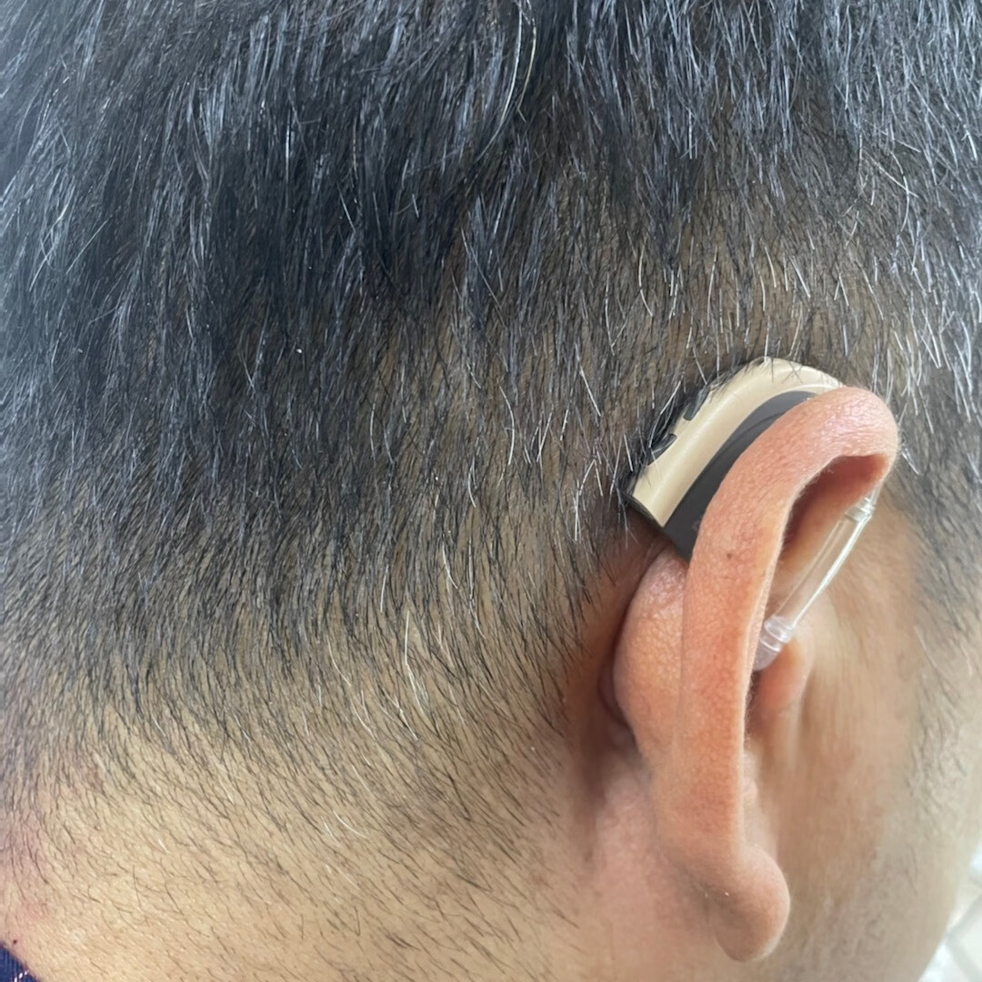 小巧便携的飞利浦助听器，给需要者带来有声的美好的第4张示图