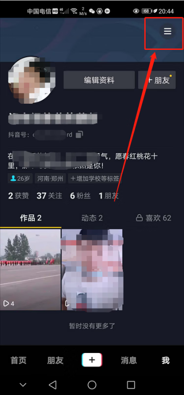 《抖音》怎么设置禁止评论