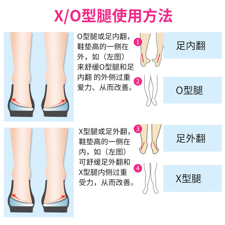 O型腿矫正鞋垫矫正x型腿罗圈腿矫正纠正改善儿童足外翻足内翻内八字外八字腿型o型腿矫正磁疗成人一双装 图片价格品牌评论 京东